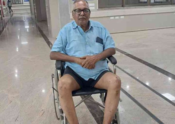 भारतीय जन महासभा के अध्यक्ष धर्म चंद्र पोद्दार सड़क दुर्घटना में घायल।